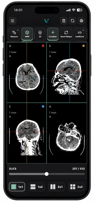 VEXA PACS mobile layout showing the same CT study in a 2x2 multiplanar grid with slice control and layout selector.